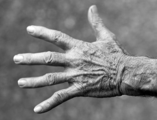 Arthritis treatment with focus on natural chitin oligosaccharides